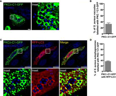 PKCα Is Recruited to Staphylococcus aureus-Containing Phagosomes and Impairs Bacterial Replication by Inhibition of Autophagy